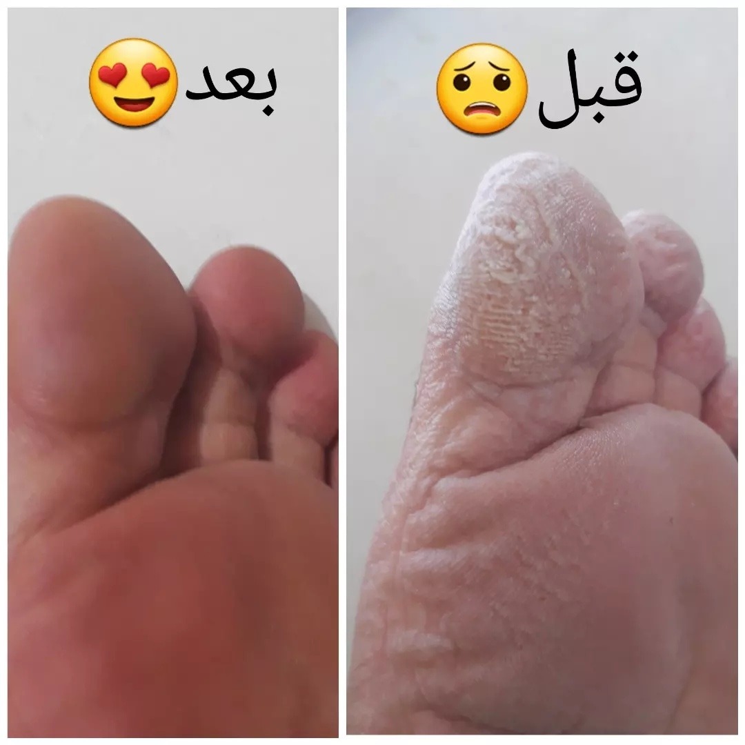 نصاب پرده و پدیکور کار