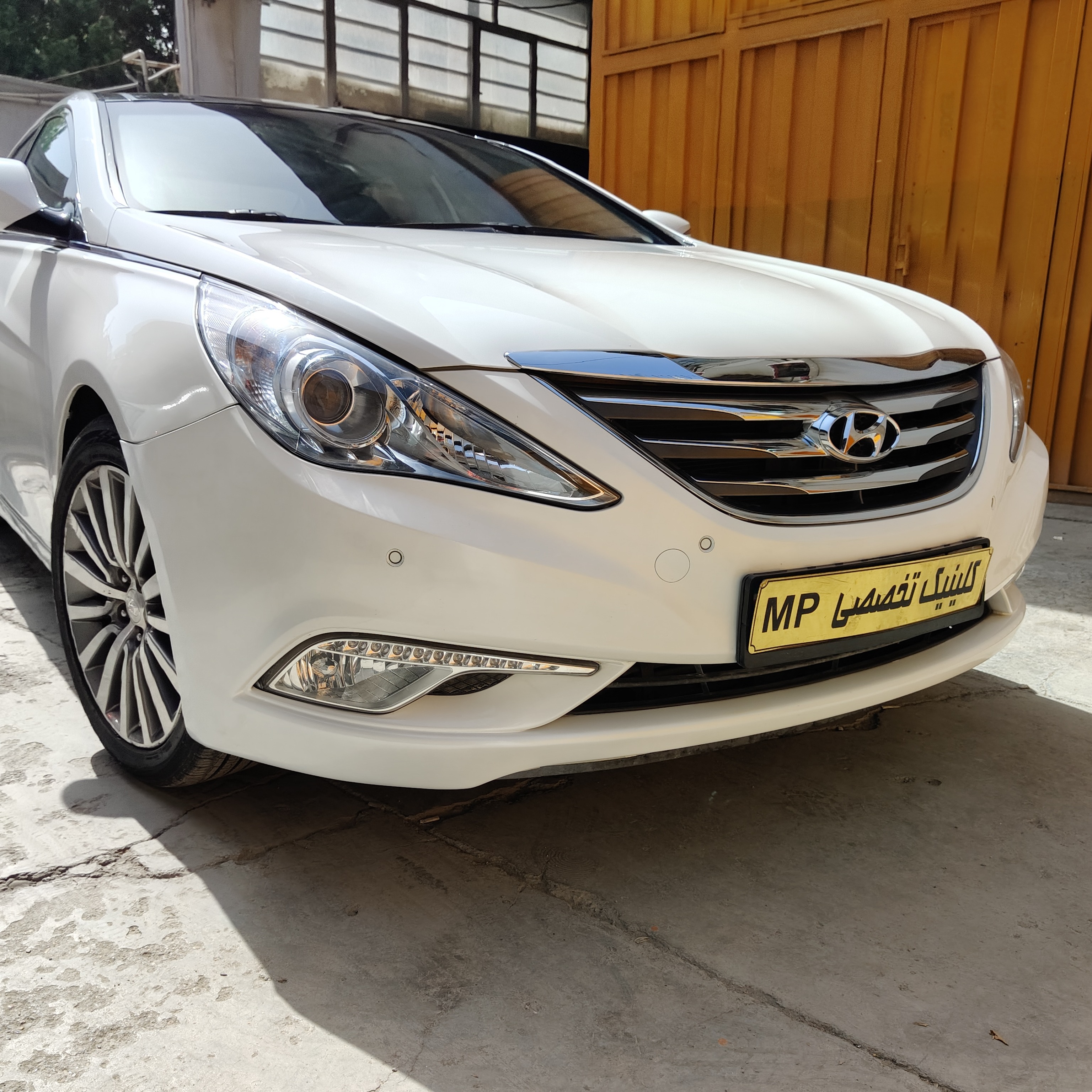 لیسه کشی سوناتا صدفی