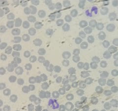 انواع آزمایش ها