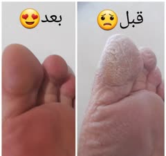 نصاب پرده و پدیکور کار