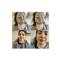 فیشیال پوست