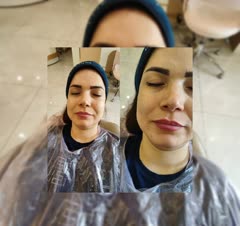 فیشیال پوست