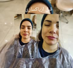 فیشیال کاربرای خانم اقا