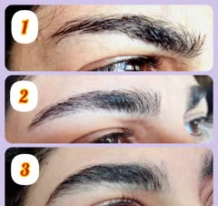 ترمیم بعد از سه جلسه ترمیم