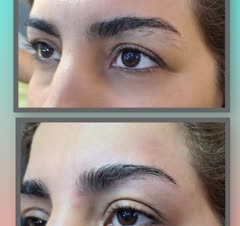 ترمیم بعد از سه جلسه ترمیم