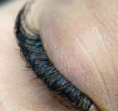 کاشت اکستنشن مگاوالیوم بلند