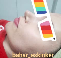 پاکسازی پوست