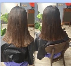 کوتاهی لیزری با موزر