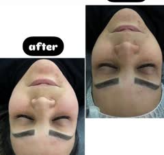 پاکسازی پوست