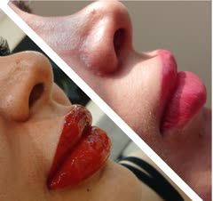 شیلدینگ لب بعد از 1 هفته و تغییر رنگ طبیعی