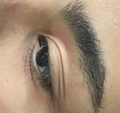 کاشت موقت تک لاین طبق سلیقه مشتری عزیز