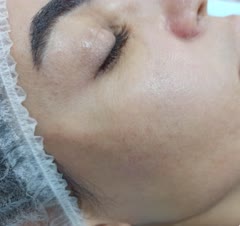 به‌روزترین سبک لیفت صورت