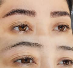 میکروبلیدینگ (فیبروزابرو)
