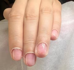 کاشت اولیه وطراحی با قلم