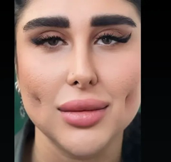 چال گونه